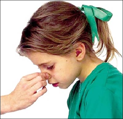慢性过敏鼻炎怎么治疗？