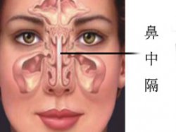 鼻中隔偏曲头晕、打鼾怎么办?