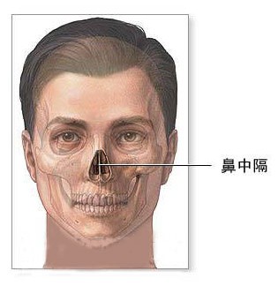 鼻中隔偏曲能导致耳鸣吗？
