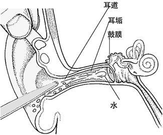 外耳道炎郑州哪家医院治疗？