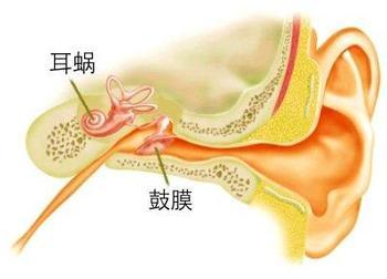 鼓膜穿孔对人们有哪些危害?