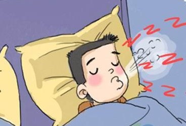 鼾症有哪些临床表现?